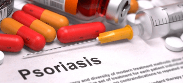 Psoriasis-Medikamente