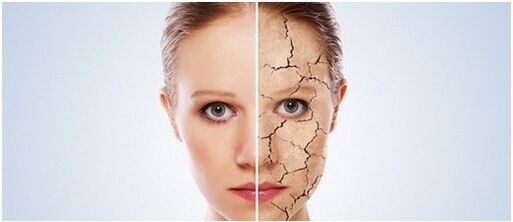 Wir behandeln Psoriasis